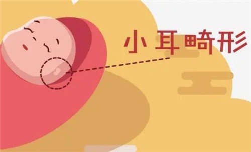 【河南中醫(yī)藥大學(xué)一附院】莊洪興教授暑假坐診，耳畸形修復(fù)限時(shí)預(yù)約！