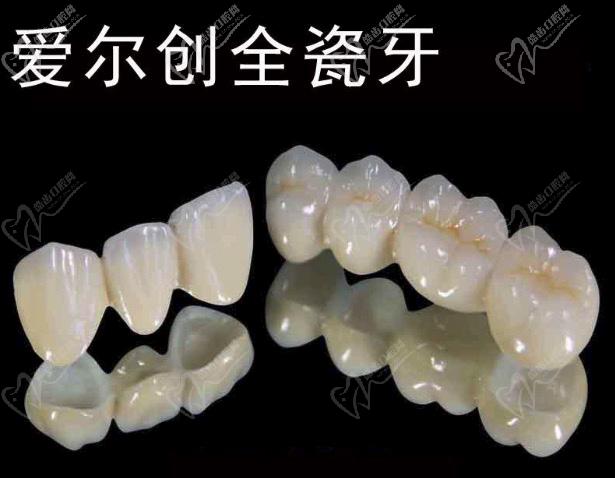 愛爾創(chuàng)和威蘭德全瓷牙有什么區(qū)別？
