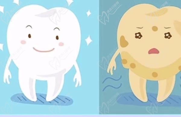 氟斑牙是什么原因造成的？