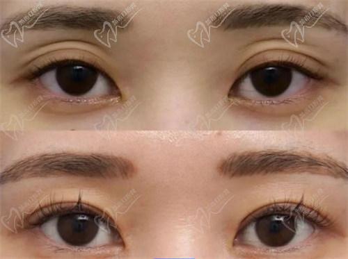師麗麗的實(shí)例可信嗎?是不是營(yíng)銷出來(lái)的?