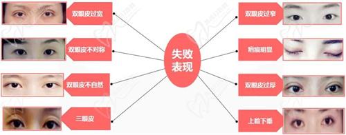 七、術(shù)前準(zhǔn)備與注意事項(xiàng)
