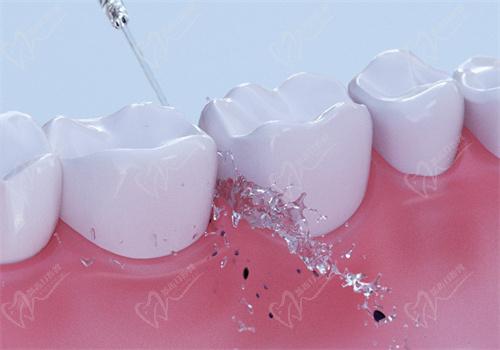 廣安愛牙仕口腔靠譜嗎