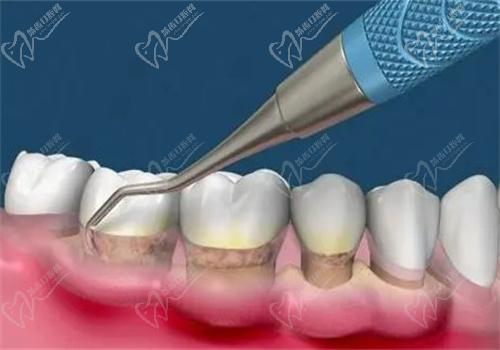廣安愛牙仕口腔靠譜嗎
