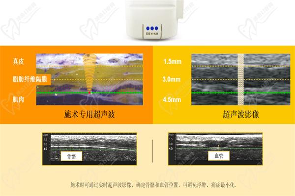 王飛醫(yī)生擅長熱瑪吉與其他抗衰項目的聯(lián)合方案