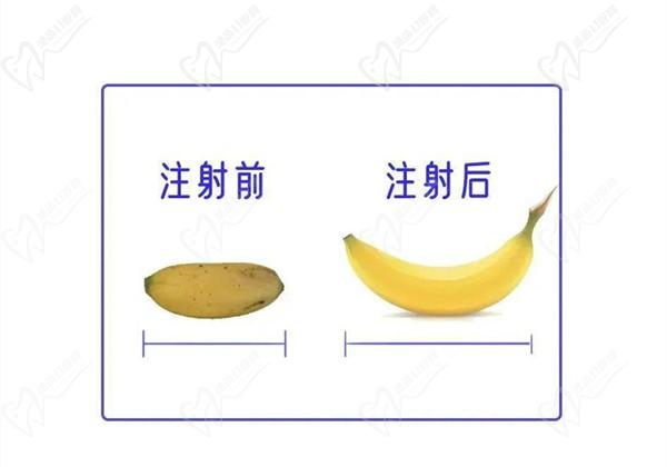 李世榮做一次延長(zhǎng)手術(shù)多少錢？2025年李世榮男科價(jià)格表延長(zhǎng)手術(shù)4.5w+假體植入3w+注射增粗5萬起