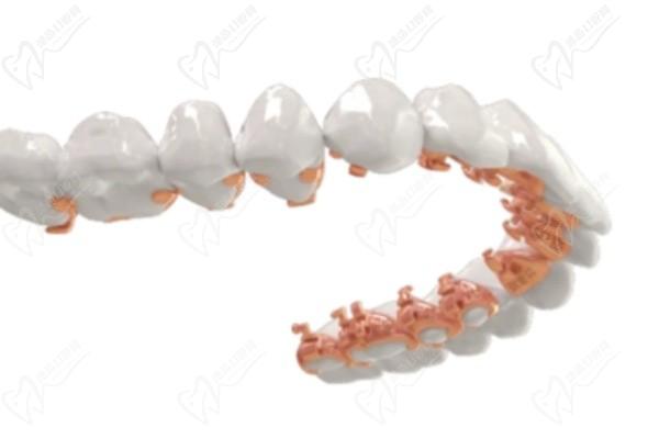 北京王小芳正畸怎么樣？博士學(xué)歷在北京中嘉口腔醫(yī)院坐診的小紅書(shū)人氣牙齒矯正醫(yī)生看全方面解析